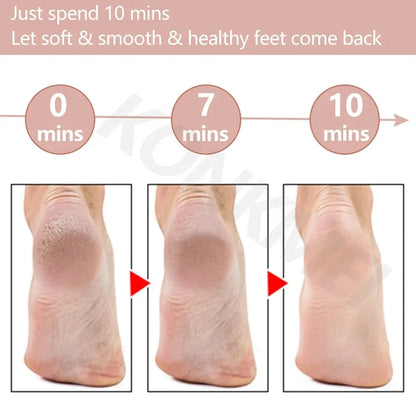 Rechargeable Electric Foot Callus Remover for Smooth Skin