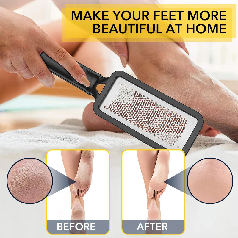 Professional Foot Scrubber Callus Remover & Pedicure Tool